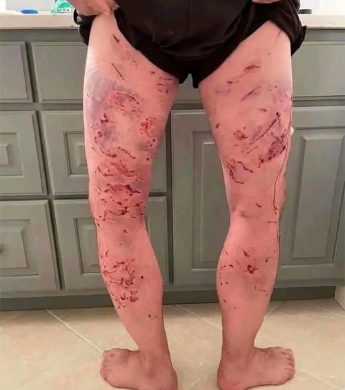 Estás son las consecuencias de dormir con…ver más